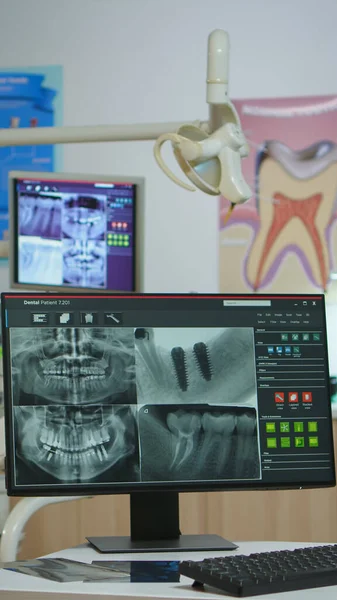 特別な機器と現代歯科医療室のインテリア — ストック写真