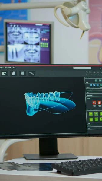 Sala medica odontoiatrica vuota con radiografia digitale sul computer — Foto Stock