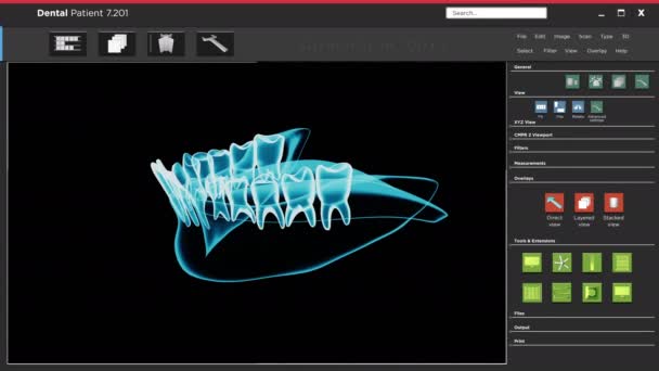 Interface da interface de usuário do aplicativo de software com varredura de raio-x dental , — Vídeo de Stock