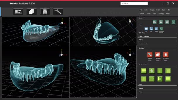 Інтерфейс програмного забезпечення рентгенівського зуба людини та сканування — стокове відео