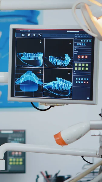 Primo piano rivelando colpo di visualizzazione stomatologia medica con immagini a raggi X — Foto Stock