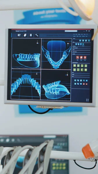 Närbild av medicinsk stomatologi display med tänder röntgen bilder på det — Stockfoto