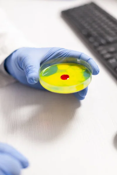 Ученый близко держит чашку Петри с образцом крови — стоковое фото