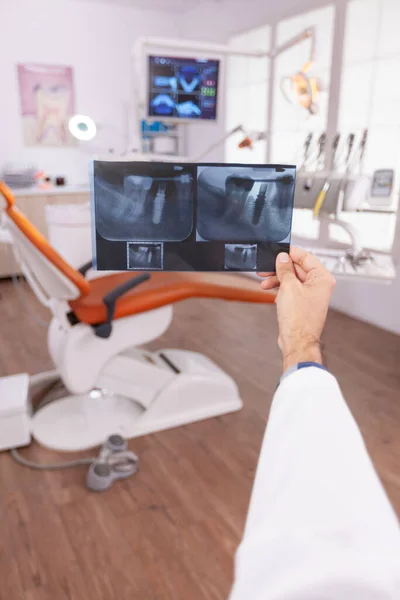 Radiologo specialista che tiene la radiografia dei denti medici nelle mani che esaminano la chirurgia dentale — Foto Stock