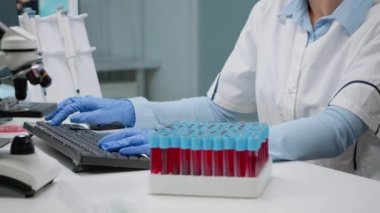 Bilimsel doktor, boştaki kan örneğini analiz ediyor.