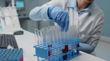 Laboratuvar bilim adamının portresi test tüpündeki kanı analiz ediyor.