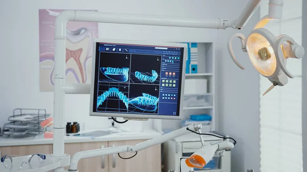 Primo piano del monitor con radiografia dentale immagini su di esso i — Foto Stock