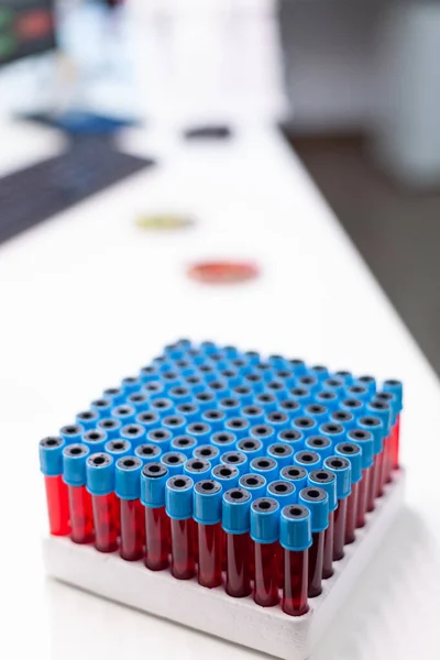 Вакутановые трубки для сбора образцов крови во время биологического исследования химии — стоковое фото