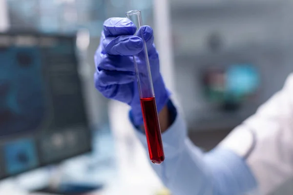 Doctor researcher holding blood test tube in hands working at microbiology experiment — Photo