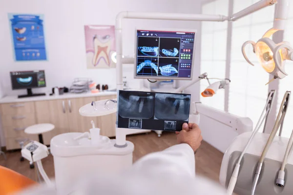 Radiolog muž lékař porovnávání lékařských zubů radiografie odborných znalostí s ústní zubní rentgen na monitoru — Stock fotografie