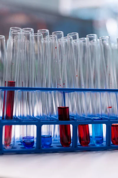 Ιατρικός δοκιμαστικός σωλήνας με αίμα να στέκεται στο τραπέζι κατά τη διάρκεια της χημικής μοριακής εξέτασης — Φωτογραφία Αρχείου
