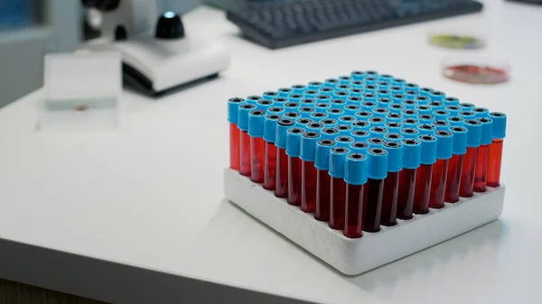 Close up de bandeja vacutainers com sangue na mesa — Fotografia de Stock