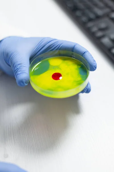 Крупный план человека-биолога, держащего медицинскую чашку Петри с образцом бактерий в ней — стоковое фото