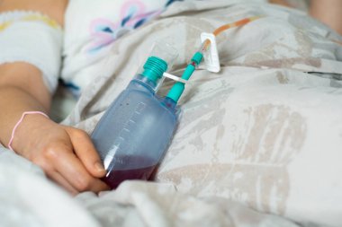 Kadın ameliyattan sonra yatakta cerrahi drenaj yapar.