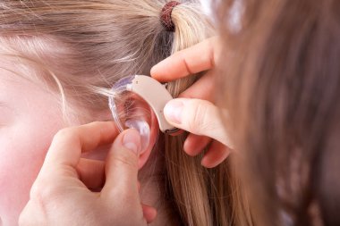 Doktor takarak işitme cihazı
