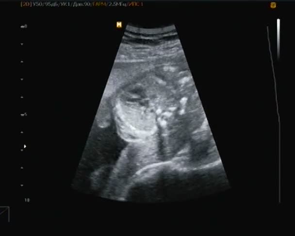 超声检查对小宝宝的心跳. — 图库视频影像