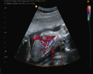 Küçük bebeğin kalp atışı Ultrasonografi.