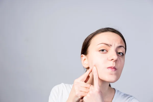 Young Woman Pricking Blackheads on her Cheek — Stock Photo, Image