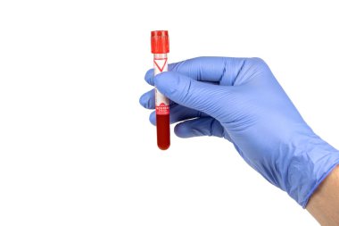 Kan plazmasıyla el ele tutuşan test tüpü test için hazır..