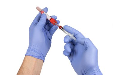 Doktor test tüpü analizinde kan örneği veriyor..