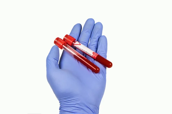 Hand Holding Test Tube Blood Plasma Ready Testing — Stock Photo, Image