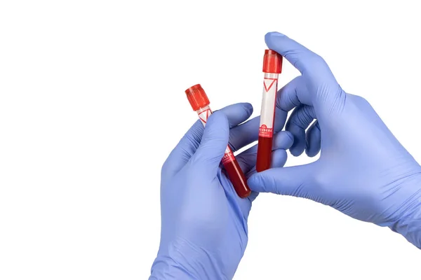 Hand Holding Test Tube Blood Plasma Ready Testing — Stock Photo, Image