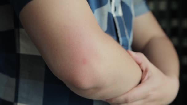 Een man brengt kou aan op een pijnlijke ellebooggewricht, close-up. Koude behandeling, verwijderen van oedeem, trauma — Stockvideo