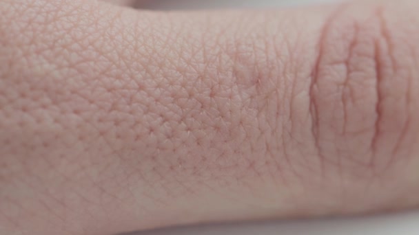 Poren auf der Haut eines Fingers in einer Person, aus nächster Nähe. Hautfeuchtigkeits- und Ernährungskonzept, Dermatologie, Makro — Stockvideo