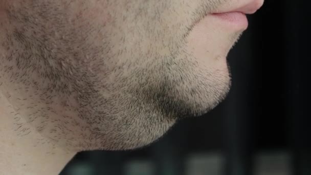 一个长着黑色胡子的男人双下巴上的脂肪沉积。消除下巴问题区域的概念，特写镜头 — 图库视频影像