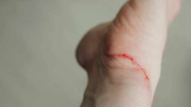Skär sår på en mans hand, närbild. Blod på handleden, hud — Stockvideo