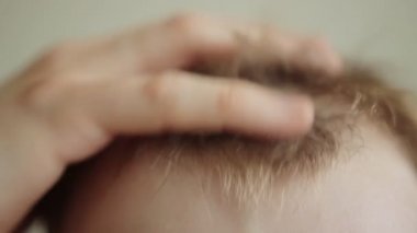 Adam alnından ter, işten ve sıcaktan ıslak saçlar siliyor. Yakın plan.