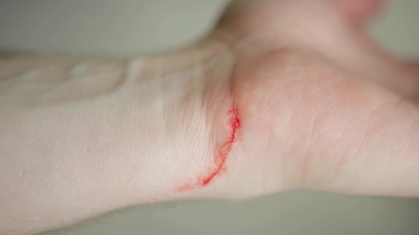 Blood on the wrist of a persons hand, close-up. Cut and wound in the skin — Stock Video