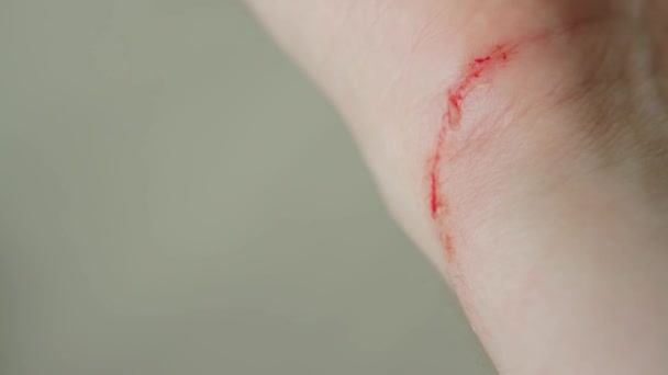 Sangre en la muñeca de una persona mano, primer plano. Corte y herida en la piel — Vídeo de stock