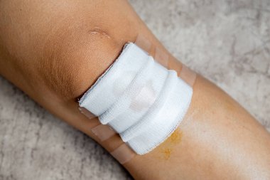 diz yarası, yakın plan, ilk yardım sonrası gazlı bez ve tıbbi bant ile yaralanmış diz, yara bakımı, yaralanma iyileşme ve sağlık bilincini gösteriyor