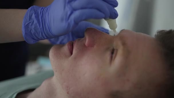 Médico usa colírio para pacientes olhos antes da correção da visão laser. — Vídeo de Stock