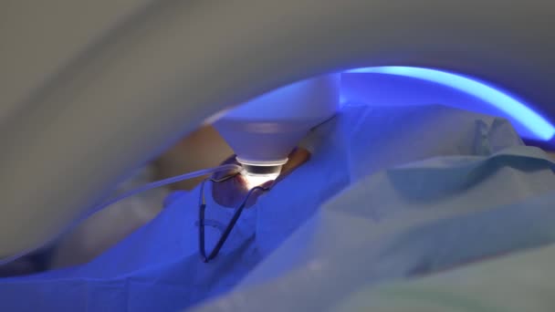 Correction des yeux au laser par la méthode SMILE. Laser se déplace de l'œil. — Video