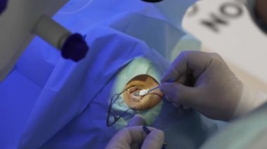 Gülümseme metodunu kullanarak lazer göz düzeltme. Doktor gözünden fazla kan alıyor.