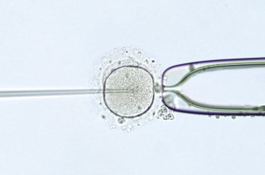 İntrasitoplazmik sperm enjeksiyonu ile suni tohumlama