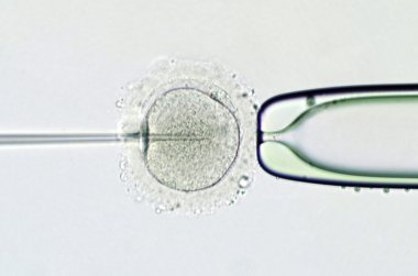 İntrasitoplazmik sperm enjeksiyonu ile suni tohumlama