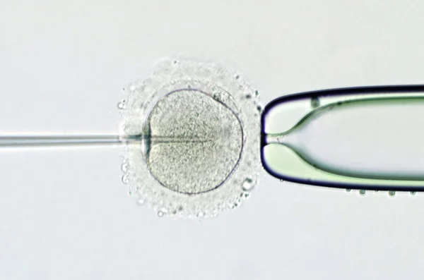 Inseminazione artificiale mediante iniezione intracitoplasmatica di sperma — Foto Stock