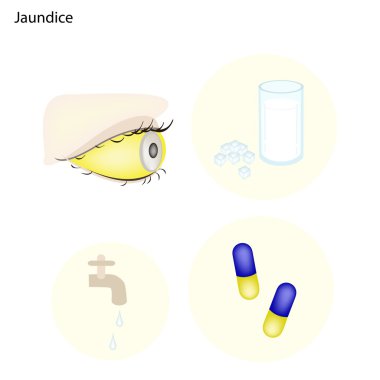 Jaundice or Icterus with Prevention and Medical Treatments clipart