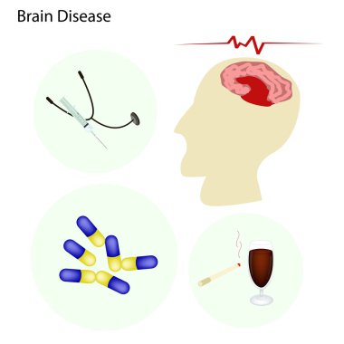 Brain Disease Concept with Disease Treatment clipart