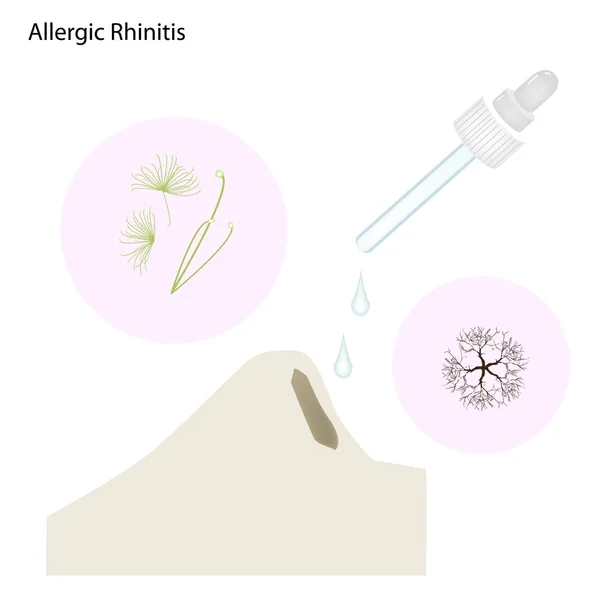 De patiënt allergische Rhinitis met neus druppels — Stockvector