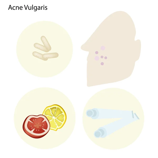 Acné Vulgaris et Prendre soin de la peau du visage — Image vectorielle
