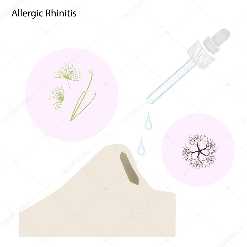 The Allergic Rhinitis Patient with Nose Drops