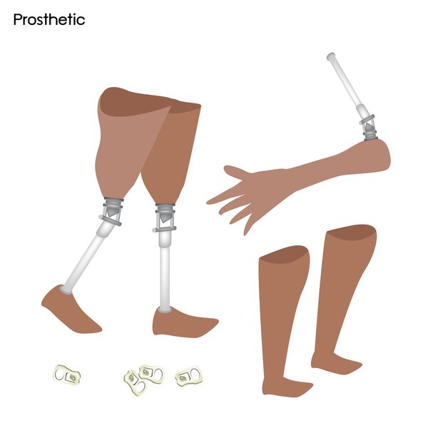Комплект протезной ноги, колена и руки

