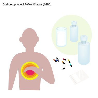 Gastroesophageal Reflux Disease or GERD with Treatment clipart