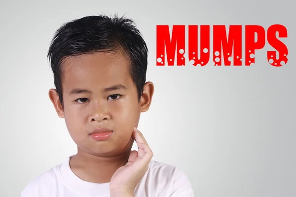 Asiatiska Boy får sjuk med påssjuka — Stockfoto
