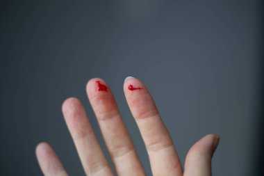 Sağ elindeki parmak kesilmiş ve parlak kırmızı kan ile kanıyor, seçici odak, bulanık koyu arkaplan