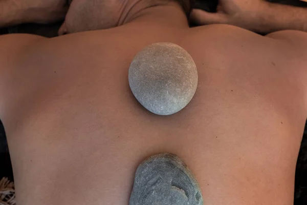 The back of a man, on which round stones are located along the line of the spine. Treatment, relaxation and spa treatments — Stock Photo, Image